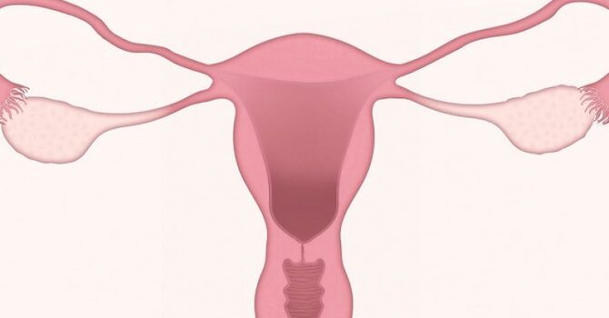 PCOS AND HOMEOPATHY image