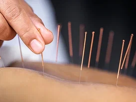 healthhavenclinic-acupuncture