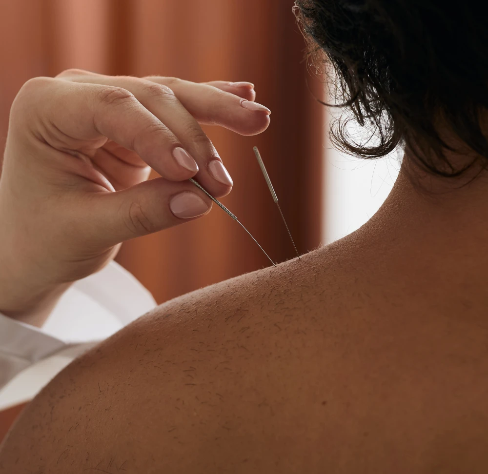 acupuncture-ontario