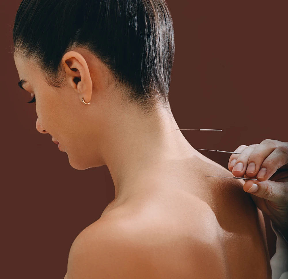 tcm-acupuncturist