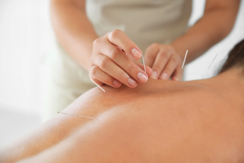 traditional-chinese-medicine-toronto