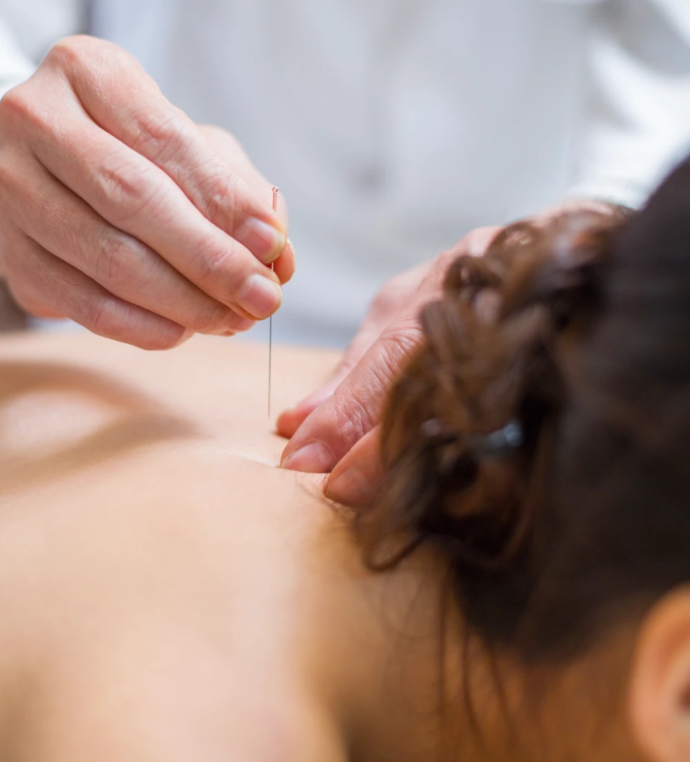 whole-body-acupuncture